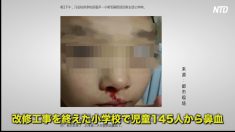 【動画ニュース】改修工事を終えた杭州市小学校　児童145人から鼻血